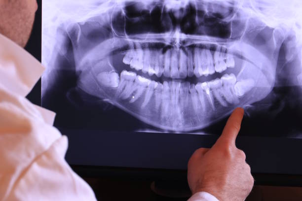 Best Chipped Tooth Repair Near Me  in Fletcher, NC